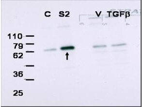 Western blot using Boster's affinity purified anti-Smad2 to detect over-expressed Smad2 in COS cells (arrow)