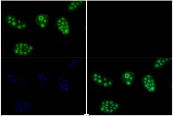 Immunofluorescence analysis of Hela cells using Smad2/3 (S2) pAb at dilution of 1:200