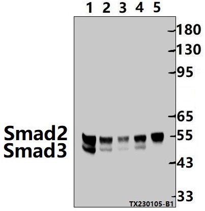 Western blot (WB) analysis of Smad2/3 (S2) pAb at 1:1000 dilution
Lane1:PC12 whole cell lysate(30ug)
Lane2:CT-26 whole cell lysate(30ug)
Lane3:Hela whole cell lysate(30ug)
Lane4:HEK293T whole cell lysate(30ug)
Lane5:EC9706 whole cell lysate(30ug)
