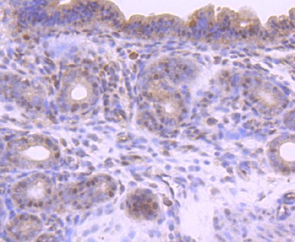 Immunohistochemical analysis of paraffin-embedded mouse uterus tissue using anti-Phospho-Smad2(S255) antibody