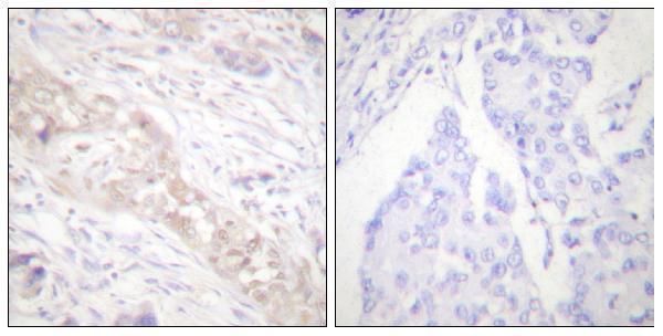 a00090s467 1 smad2 primary antibodies ihc testing 5