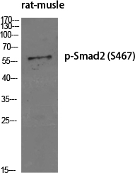 Western Blot analysis of various cells using Phospho-Smad2 (S467) Polyclonal Antibody diluted at 1:500