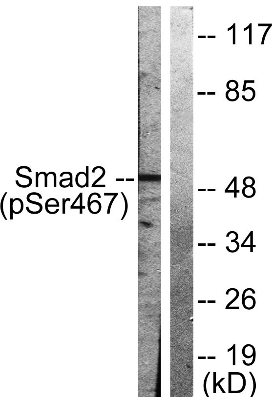 Western blot analysis of lysates from HepG2 cells treated with PMA 125ng/ml 15