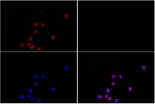 Immunofluorescence analysis of HepG2 cells using Smad2 (phospho-S467) pAb at dilution of 1:200 (40x lens)
