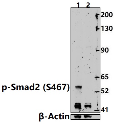 Western blot (WB) analysis of Smad2 (phospho-Ser467) polyclonal antibody at 1:500 dilution
Lane1:HepG2 treated with TGF-β(100 ng/ml,30 minutes) whole cell lysate(30ug)                                                                                           Lane2:HepG2 whole cell lysate(30ug)