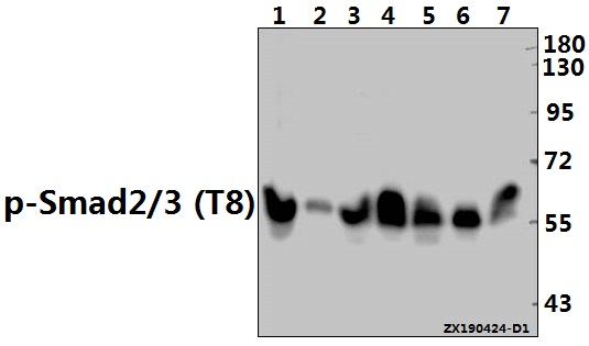 Western blot (WB) analysis of Smad2/3 (Phospho-T8) polyclonal antibody at 1:500 dilution
Lane1:C6 whole cell lysate(40ug)
Lane2:MEF whole cell lysate(40ug)
Lane3:A2780 whole cell lysate(40ug)
Lane4:A549 whole cell lysate(40ug)
Lane5:A375 whole cell lysate(40ug)
Lane6:MCF-7 whole cell lysate(30ug)
Lane7:Hela whole cell lysate(30ug)