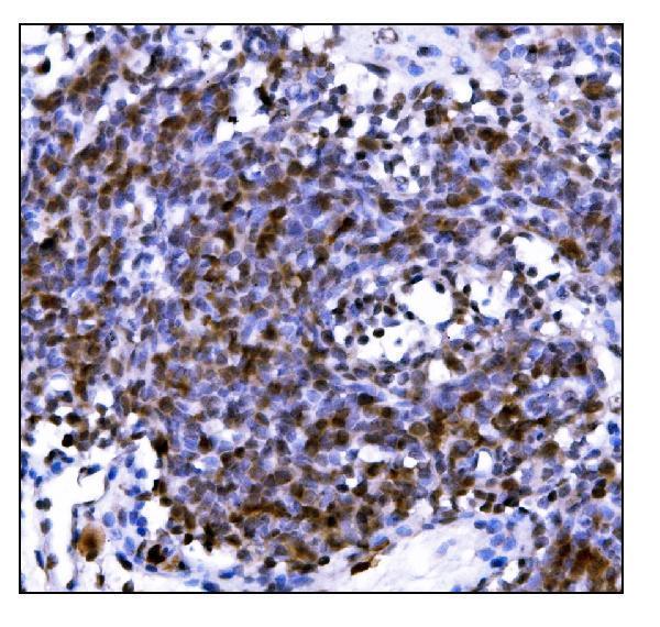  IHC analysis of PML Protein/Pml using anti-PML Protein/Pml antibody (A00093-2)