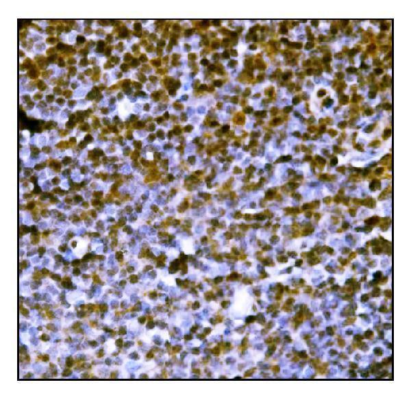  IHC analysis of PML Protein/Pml using anti-PML Protein/Pml antibody (A00093-2)