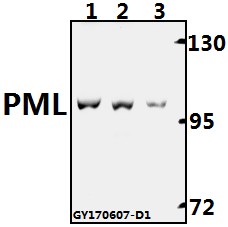 Western blot (WB) analysis of PML (P39) pAb at 1:500 dilution
Lane1:L02 whole cell lysate(40ug)
Lane2:HEK293T whole cell lysate(40ug)
Lane3:A549 whole cell lysate(40ug)