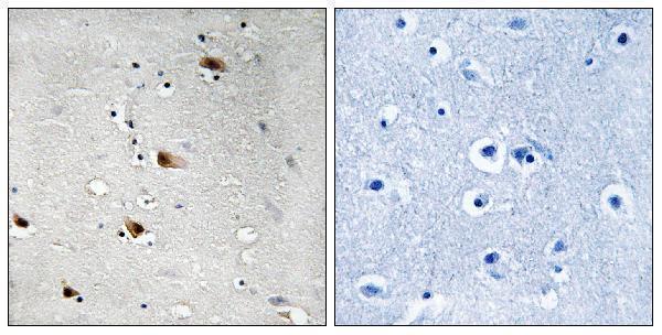 Immunohistochemistry analysis of paraffin-embedded human brain, using E2A (Phospho-Thr355) Antibody