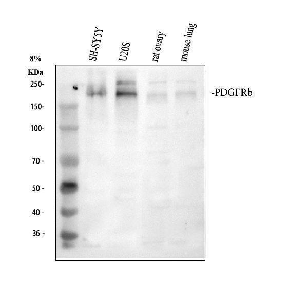 a00096 1 pdgfrb primary antibodies wb testing 1_2