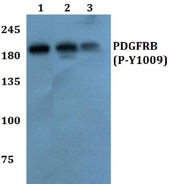 a00096y1009 pdgfrb primary antiboties wb testing 1_1