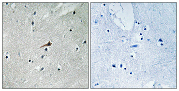 a00096y740 1 pdgfrb primary antibodies ihc testing 3