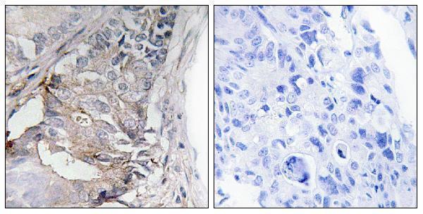 a00096y740 1 pdgfrb primary antibodies ihc testing 4