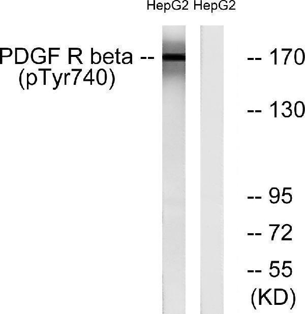 a00096y740 1 pdgfrb primary antibodies wb testing 2