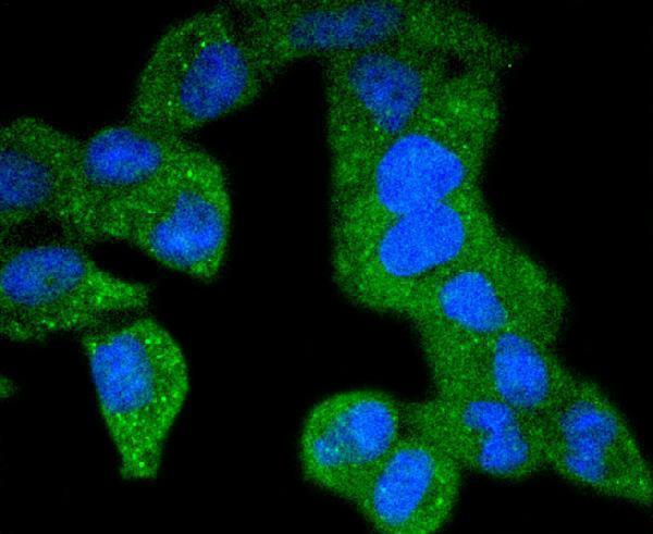 a00096y740 pdgfrb primary antiboties icc testing 2