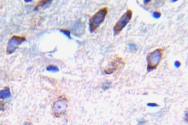 a00096y751 1 pdgfrb primary antiboties ihc testing 2