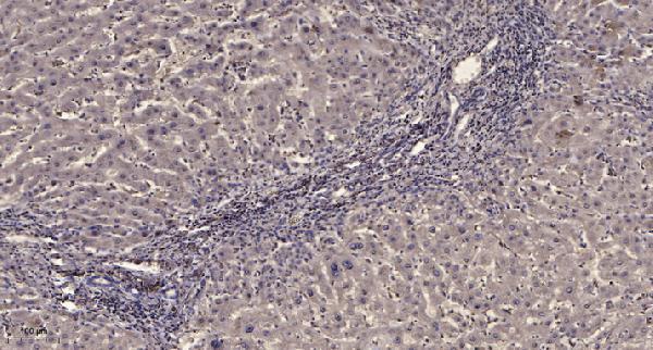 a00096y771 pdgfrb primary antibodies ihc testing 1