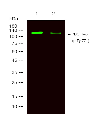 a00096y771 pdgfrb primary antibodies wb testing 2