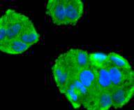 a00097 2 mapt primary antiboties icc testing 2