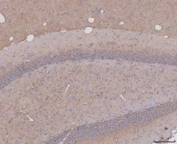 a00097 3 mapt primary antibodies ihc testing 1