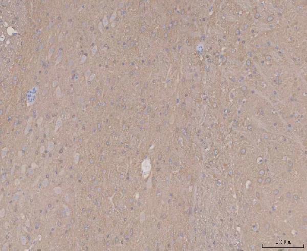 a00097 3 mapt primary antibodies ihc testing 2