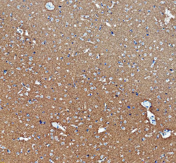 a00097 3 mapt primary antibodies ihc testing 3