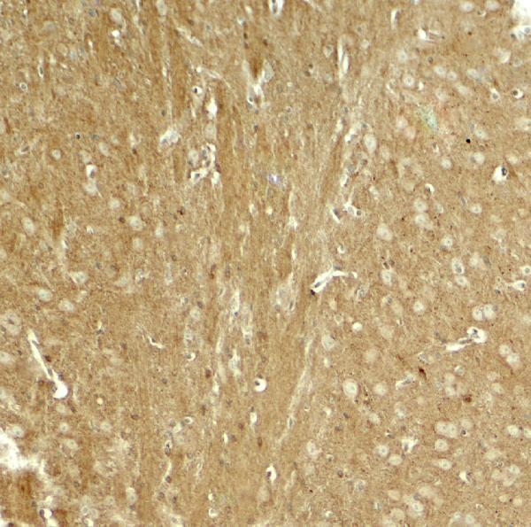a00097 tau primary antibodies ihc testing 2