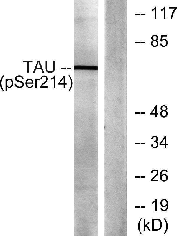 a00097s214 mapt primary antibodies wb testing 1