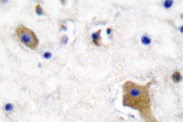 a00097s356 mapt primary antiboties ihc testing 2