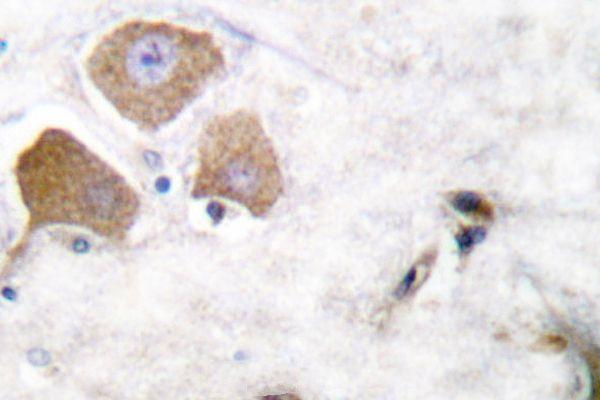 a00097s396 mapt primary antiboties ihc testing 2