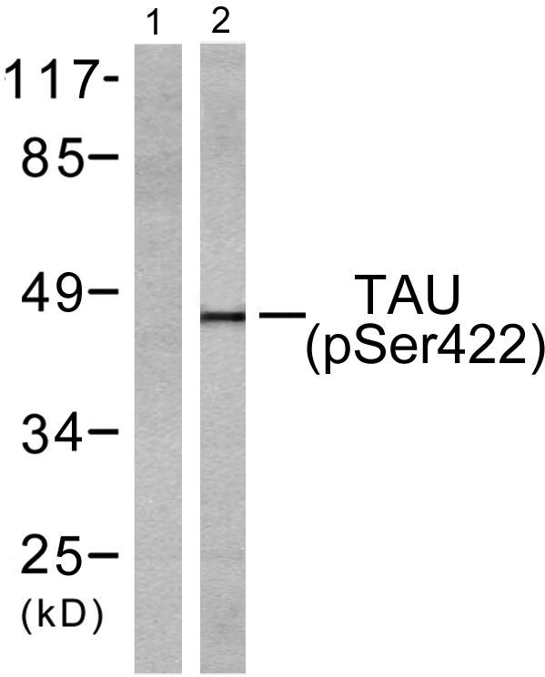 a00097s422 mapt primary antibodies wb testing 2