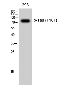 a00097t181 1 mapt primary antibodies wb testing 2
