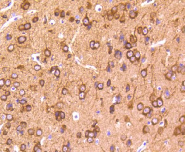 a00097t231 1 mapt primary antiboties ihc testing 2