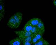 a00098 1 fgfr1 primary antiboties icc testing 2