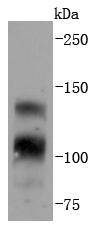 a00098 1 fgfr1 primary antiboties wb testing 1