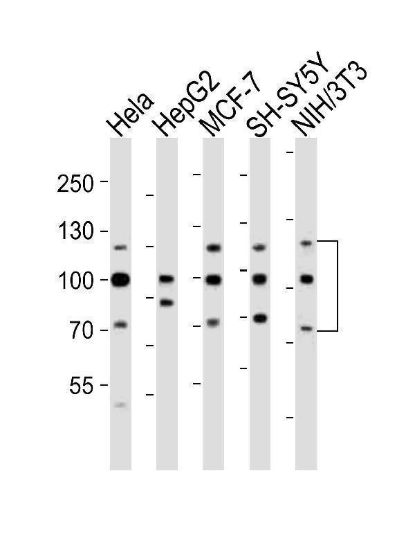 a00098 2 anti fgfr1 antibody center wb testing 1