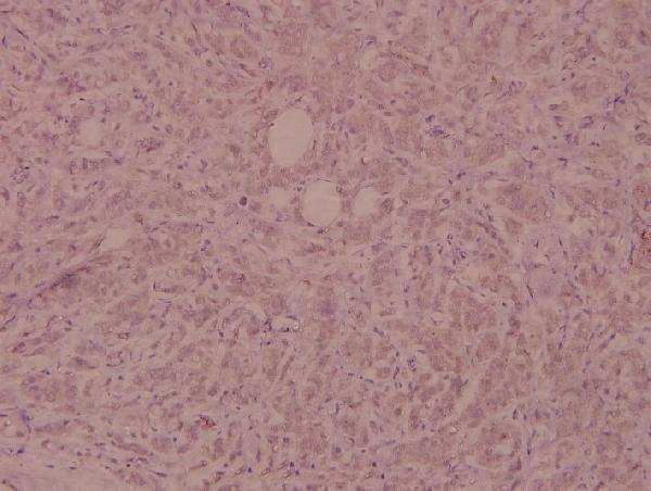 a00098y154 1 fgfr1 primary antiboties ihc testing 2