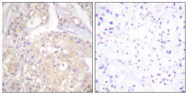 a00098y766 1 fgfr1 primary antibodies ihc testing 1