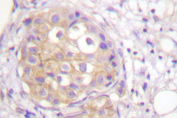 a00098y766 fgfr1 primary antiboties ihc testing 2