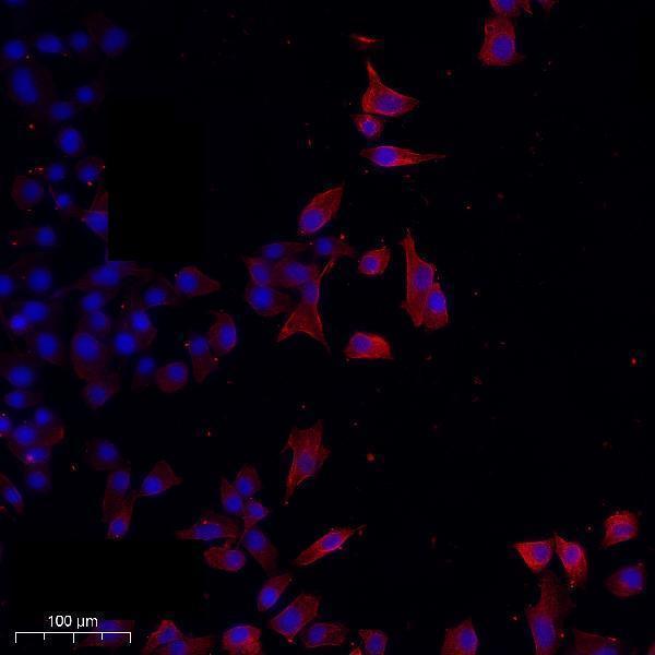 a00099 1 nras primary antibodies if testing 1
