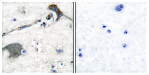 a00099 1 nras primary antibodies ihc testing 4