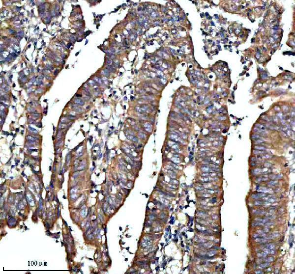 IHC analysis of NRAS using anti-NRAS antibody (A00099-3)