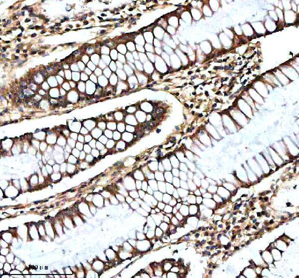 IHC analysis of NRAS using anti-NRAS antibody (A00099-3)