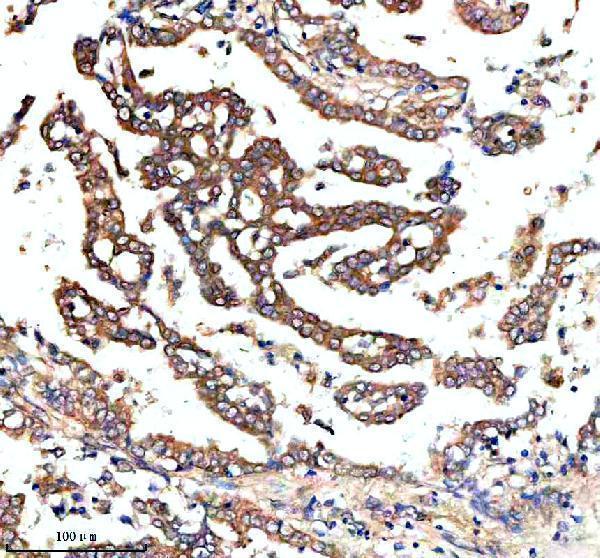 a00099 3 nras primary antibodies ihc testing 3
