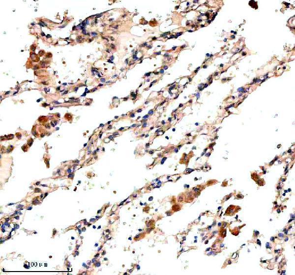 a00099 3 nras primary antibodies ihc testing 4