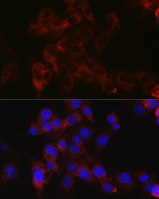 Immunofluorescence analysis of mouse liver cells using ApoB Rabbit pAb  at dilution of 1:100 
