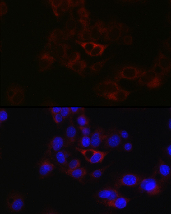Immunofluorescence analysis of HepG2 cells using ApoB Rabbit pAb  at dilution of 1:50 