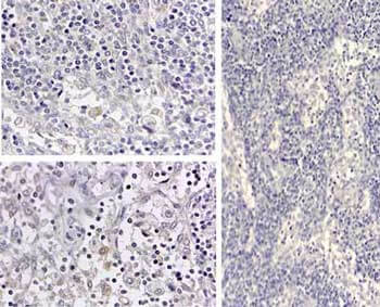 Immunohistochemistry of Human IL1 beta antibody