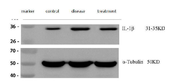 a00101 il1b primary antibodies wb review 1_1